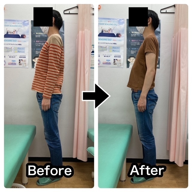 腰椎ヘルニアの痛み・しびれをさくら整骨院で改善させた40代男性会社員のビフォーアフター画像