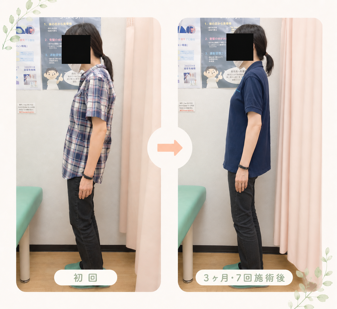 姿勢を気をつけ続けなくても自然に立ちやすくなった変化を、初回と3ヶ月・7回施術後で比較したビフォーアフター画像
