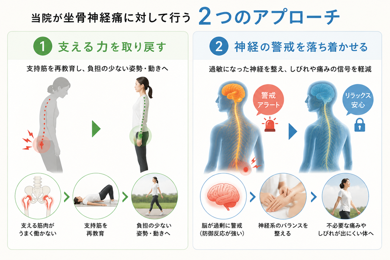 坐骨神経痛に対して支持筋の再教育と神経系の調整を行う2つの施術アプローチを解説した図