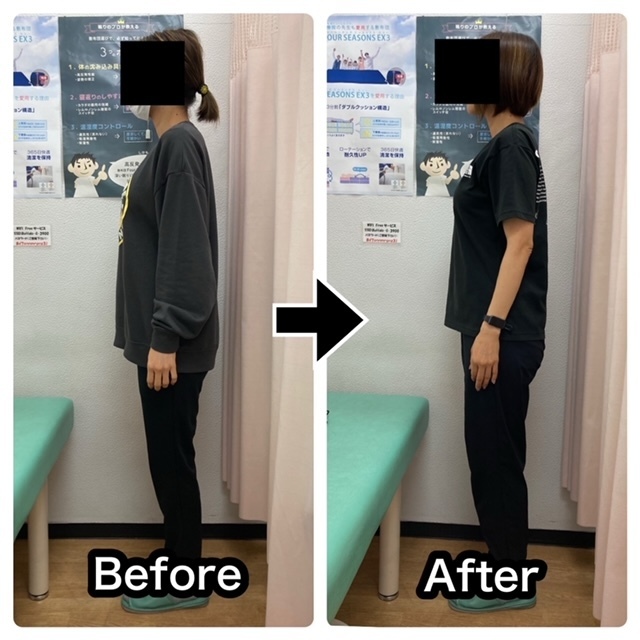 側弯、O脚、ストレートネック等が改善されたクライアントさんのビフォーアフター写真（大田区・さくら整骨院）