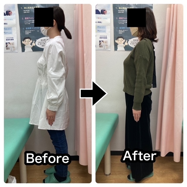 慢性的な腰痛をさくら整骨院で改善させた40代女性会社員の比較画像