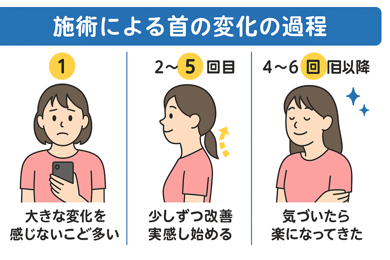 「首の施術による変化の過程を示した図解。①1回目：大きな変化を感じないことが多い、②2～5回目：少しずつ改善を実感し始める、③4～6回目以降：気づいたら楽になってきた、という3段階を視覚的に表現している。」