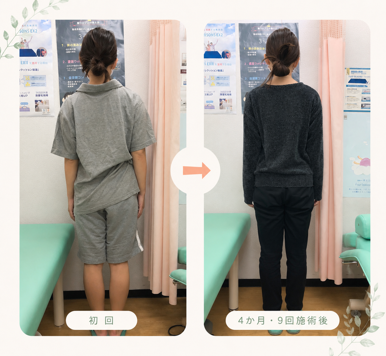 姿勢バランスの変化を、初回と4か月・9回施術後で比較したビフォーアフター画像。左右差や立ち姿勢の安定感が自然に変化している様子。
