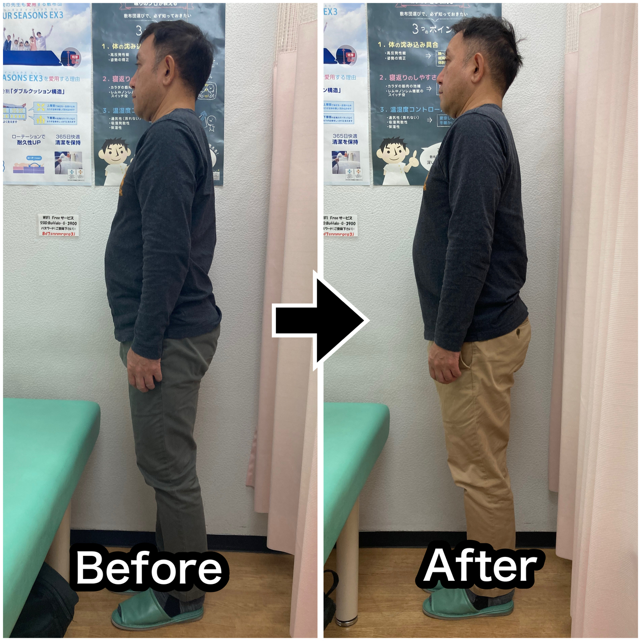 さくら整骨院で首のこりを改善させた50代男性現場監督のビフォーアフター写真