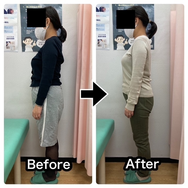 さくら整骨院で目まいを安定させた50代女性のビフォーアフター画像