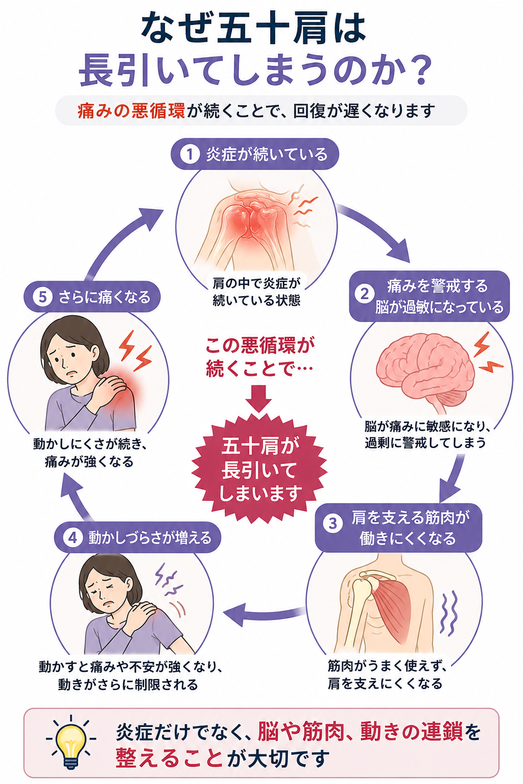 五十肩が長引く原因として、炎症・脳の感作・肩を支える筋肉の機能低下・動かしづらさが悪循環を作る様子を説明した図