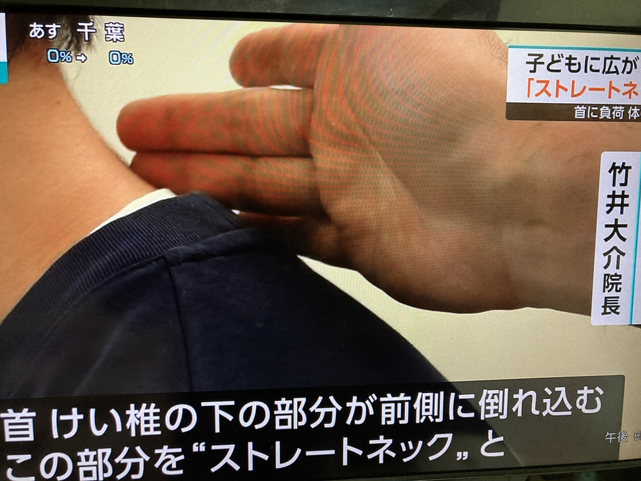 NHKにて放送されたさくら整骨院でのストレートネックの説明