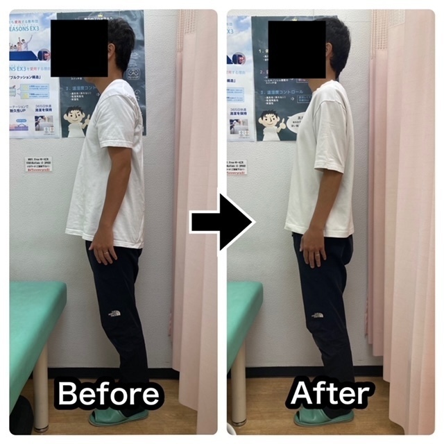 さくら整骨院で目まいを改善させた40代男性会社経営者のビフォーアフター画像