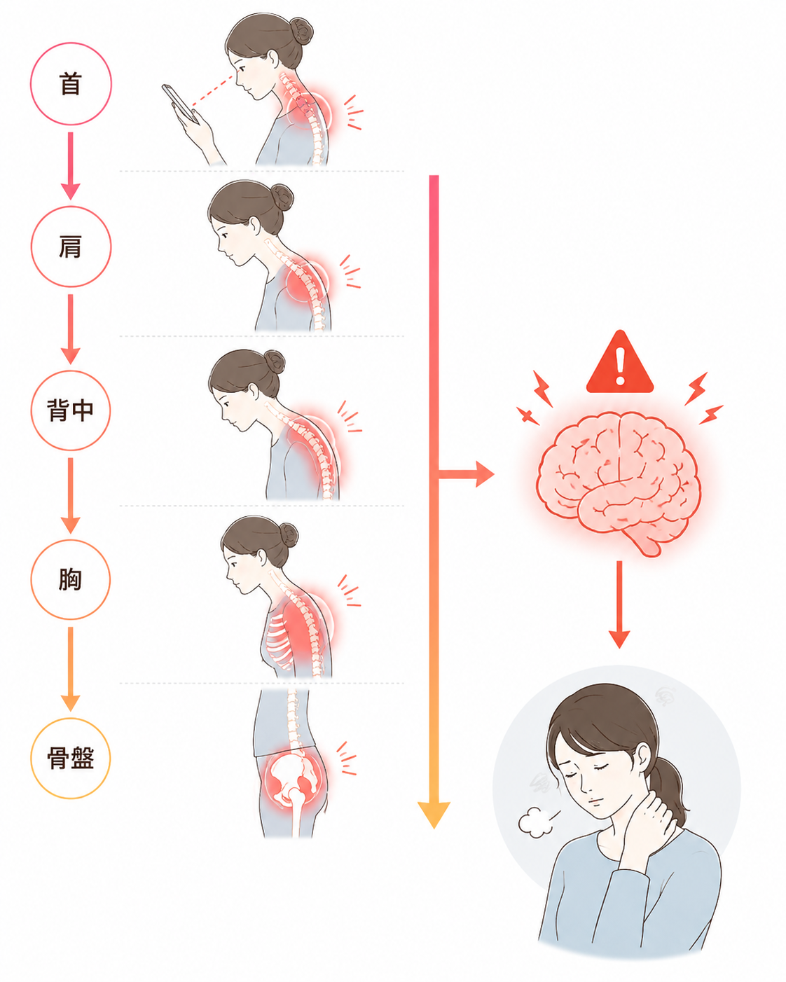スマホ首は首だけを整えても解決せず、視線を下げ続けることで肩・背中・胸・骨盤まで負担が連動して広がることを図解したイラスト。スマホを見る姿勢の変化と、身体全体への負担の広がりを視覚的に説明している。