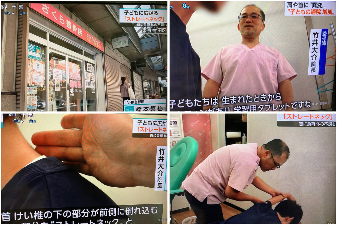 NHKにて放送されたさくら整骨院での子供の施術風景など4種類の画像