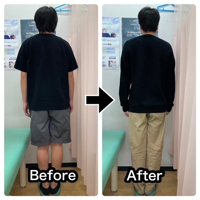 慢性的な腰痛をさくら整骨院で改善させた30代男性公務員の比較画像