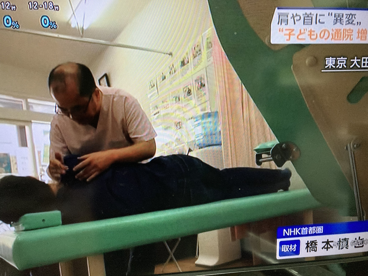 NHKで放送されたさくら整骨院での施術光景
