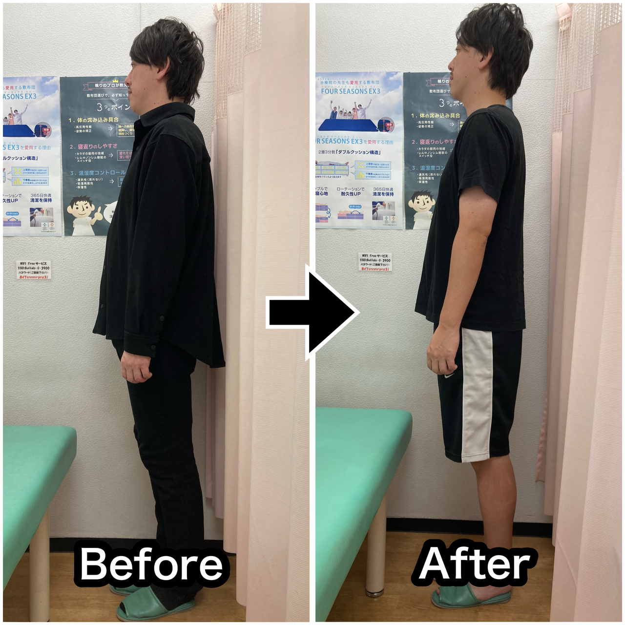 さくら整骨院で首の不調を改善させた30代男性のビフォーアフター写真