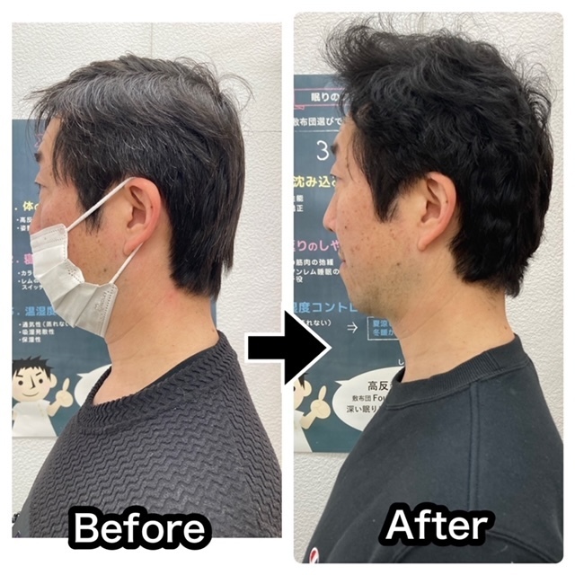 さくら整骨院で首の痛みやしびれを改善させた50代男性会社員のビフォーアフター写真
