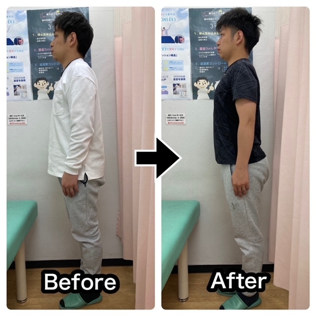 強い首・肩の痛み、頭痛が改善されたクライアントさんのビフォーアフター写真（大田区・さくら整骨院）