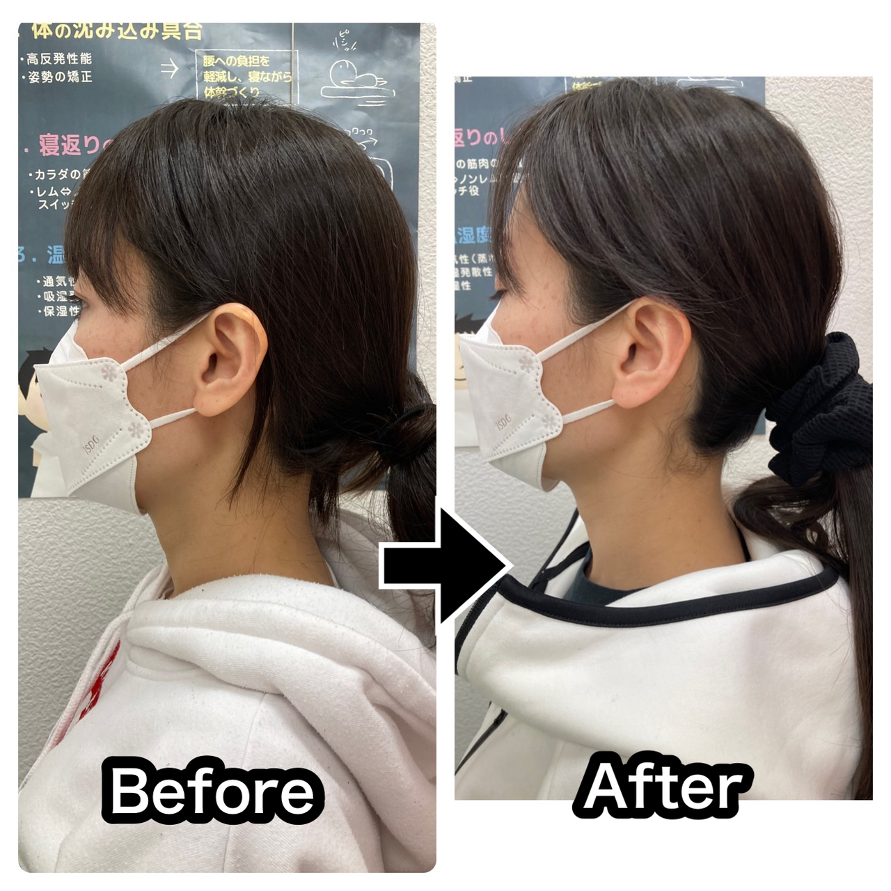 さくら整骨院で首の重さを改善した40代飲食業の女性のビフォーアフター写真
