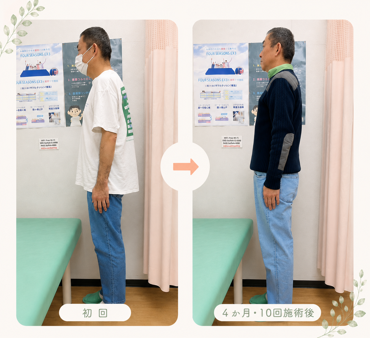 猫背気味だった男性の姿勢が、3ヶ月・7回施術後に自然に立ちやすい姿勢へ変化した様子を比較したビフォーアフター画像