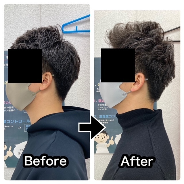 さくら整骨院で首痛や腰痛を改善した30代男性会社員のビフォーアフター写真