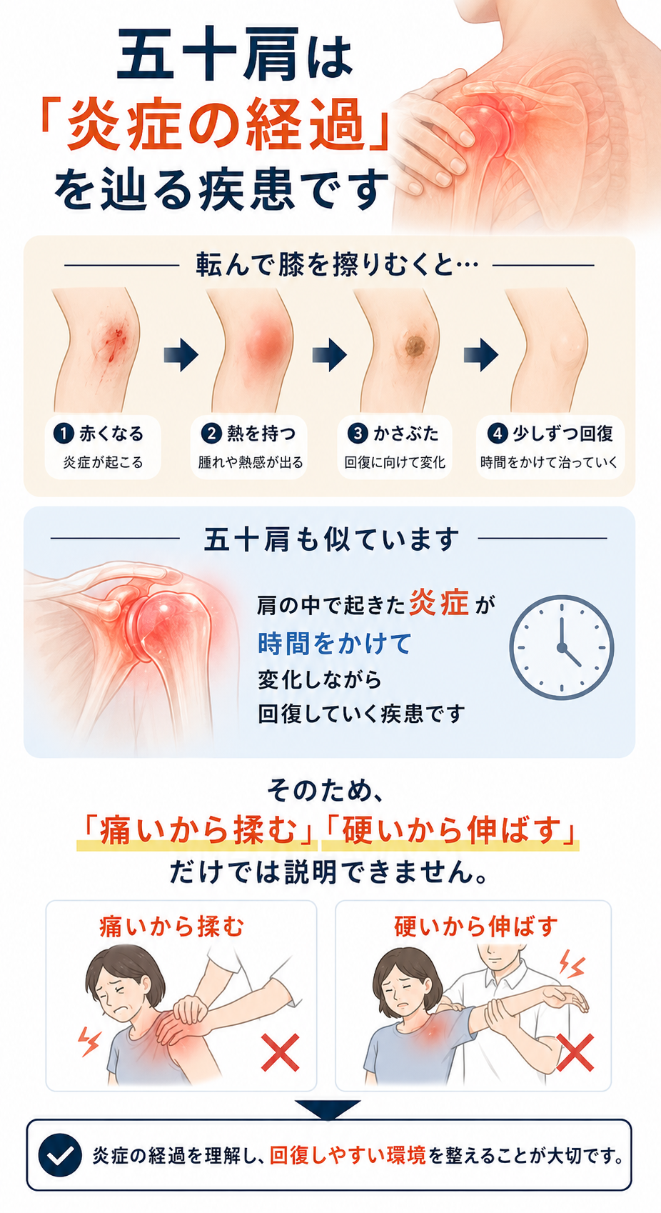 五十肩が炎症の経過を辿りながら時間をかけて回復していく疾患であることを説明した図