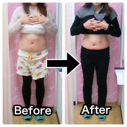 がんばらずにお腹やせ - 大田区・大森駅で首痛・スマホ首・姿勢改善